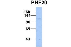 Host:  Rabbit  Target Name:  WT1  Sample Type:  721_B  Antibody Dilution:  1. (PHF20 抗体  (C-Term))