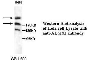 Image no. 1 for anti-Alstrom Syndrome 1 (ALMS1) antibody (ABIN1574631) (ALMS1 抗体)