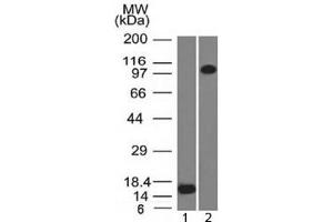 Western blot testing of 1) recombinant partial protein and 2) human ThP1 lysate with Thrombomodulin antibody (clone THBD/1591). (Thrombomodulin 抗体  (AA 69-194))