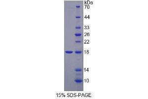 SDS-PAGE analysis of Mouse MARS Protein. (MARS 蛋白)