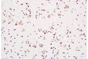 Immunohistochemistry (Paraffin-embedded Sections) (IHC (p)) image for anti-Proliferating Cell Nuclear Antigen (PCNA) (AA 151-261) antibody (ABIN676583)