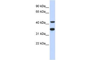 WB Suggested Anti-POLD2 Antibody Titration:  0. (POLD2 抗体  (N-Term))