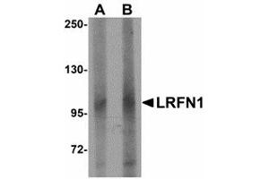 Image no. 1 for anti-Leucine Rich Repeat and Fibronectin Type III Domain Containing 1 (LRFN1) (C-Term) antibody (ABIN478048) (LRFN1 抗体  (C-Term))