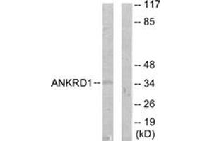 Western blot analysis of extracts from COLO205 cells, using ANKRD1 Antibody. (ANKRD1 抗体  (AA 231-280))