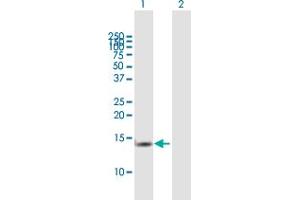 Western Blotting (WB) image for anti-Transcription Elongation Factor B (SIII), Polypeptide 2 (18kDa, Elongin B) (TCEB2) (AA 1-118) antibody (ABIN948530)