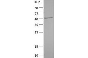 IRF3 Protein (AA 2-427) (His tag)