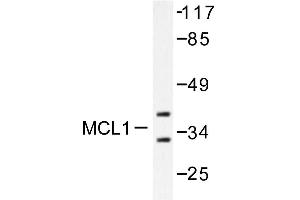 Image no. 1 for anti-Induced Myeloid Leukemia Cell Differentiation Protein Mcl-1 (MCL1) antibody (ABIN265513) (MCL-1 抗体)