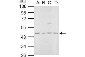 WB Image MVD antibody detects MVD protein by Western blot analysis. (MVD 抗体  (Center))