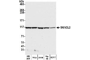 Western Blotting (WB) image for anti-Superkiller Viralicidic Activity 2-Like 2 (SKIV2L2) (AA 100-150) antibody (ABIN7449416) (MTR4 抗体  (AA 100-150))
