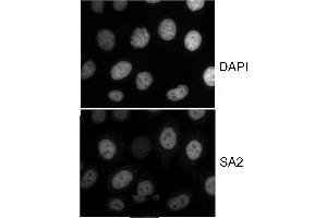 Immunocytochemistry (ICC) image for anti-Stromal Antigen 2 (STAG2) (AA 1125-1175) antibody (ABIN7453336)