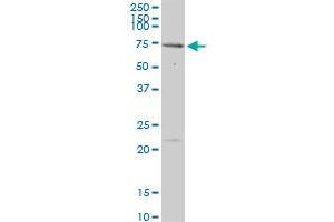 MEN1 MaxPab polyclonal antibody. (Menin 抗体  (AA 1-575))