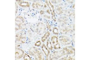 Immunohistochemistry of paraffin-embedded mouse kidney using UBQLN2 Rabbit pAb (ABIN6127815, ABIN6149859, ABIN6149860 and ABIN6225041) at dilution of 1:250 (40x lens). (Ubiquilin 2 抗体  (AA 1-150))