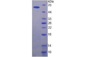 SDS-PAGE analysis of Human P-glycoprotein 1 Protein. (Permeability Glycoprotein 蛋白)