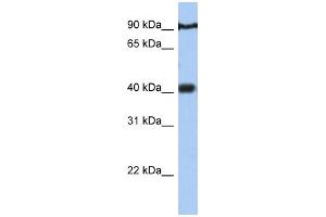 WB Suggested Anti-PTOV1 Antibody Titration:  0. (PTOV1 抗体  (N-Term))