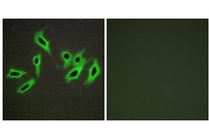 Immunofluorescence analysis of HepG2 cells, using Heparin Cofactor II antibody. (SERPIND1 抗体  (N-Term))