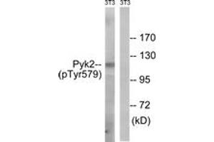 Western blot analysis of extracts from NIH-3T3 cells, using PYK2 (Phospho-Tyr579) Antibody. (PTK2B 抗体  (pTyr579))