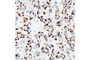 Immunohistochemistry of paraffin-embedded human liver using A-RAF Rabbit mAb (ABIN7271263) at dilution of 1:100 (40x lens). (ARAF 抗体)