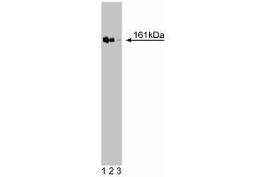 Western blot analysis of TopBP1 on a Jurkat cell lysate (Human T-cell leukemia, ATCC TIB-152). (TOPBP1 抗体  (AA 204-416))