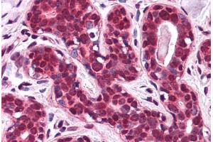 Immunohistochemistry (Formalin-fixed Paraffin-embedded Sections) (IHC (fp)) image for anti-Solute Carrier Family 5 (Iodide Transporter), Member 6 (SLC5A6) (N-Term) antibody (ABIN625852)