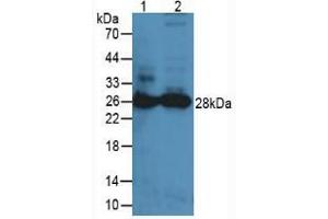 Western blot analysis of (1) Mouse Lung Tissue and (2) Mouse Spleen Tissue. (PRTN3 抗体  (AA 24-249))