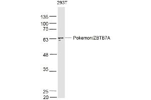 293T lysates probed with PokemonZBTB7A Polyclonal Antibody, Unconjugated  at 1:500 dilution and 4˚C overnight incubation. (ZBTB7A 抗体  (AA 151-250))