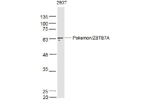 293T lysates probed with PokemonZBTB7A Polyclonal Antibody, Unconjugated  at 1:500 dilution and 4˚C overnight incubation. (ZBTB7A 抗体  (AA 151-250))