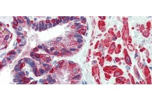 Rabbit Anti-KIF13B Antibody  arp33926 Paraffin Embedded Tissue: Human Prostate Antibody Concentration: 5 ug/ml (KIF13B 抗体  (N-Term))