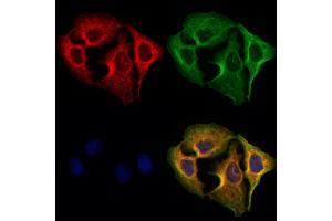 ABIN6265416 and ABIN6273079 staining Hela cells by IF/ICC. (SYVN1 抗体  (Internal Region))