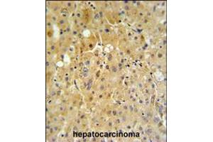 Immunohistochemistry (IHC) image for anti-Cytochrome P450, Family 2, Subfamily B, Polypeptide 6 (CYP2B6) (AA 462-488) antibody (ABIN5534097)