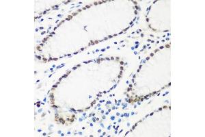 Immunohistochemistry of paraffin-embedded human stomach using HT antibody  at dilution of 1:100 (40x lens).