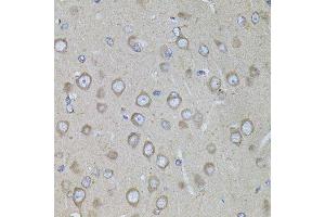 Immunohistochemistry (Paraffin-embedded Sections) (IHC (p)) image for anti-Corticotropin Releasing Hormone Receptor 1 (CRHR1) (AA 24-120) antibody (ABIN6139034)