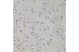 Immunohistochemistry of paraffin-embedded rat brain using CRHR1 antibody. (CRHR1 抗体  (AA 24-120))