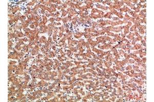 Immunohistochemistry (IHC) image for anti-Tumor Necrosis Factor Receptor Superfamily, Member 9 (TNFRSF9) (AA 111-160) antibody (ABIN7189421)