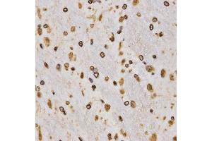 Immunohistochemistry (IHC) image for anti-Histone 3 (H3) (H3K27me) antibody (ABIN6219521)