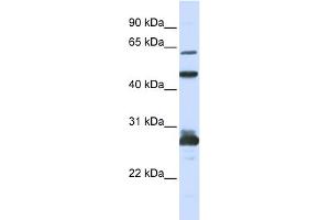 WB Suggested Anti-PES1 Antibody Titration: 0. (PES1 抗体  (C-Term))