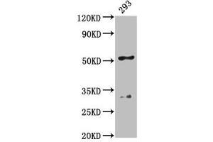 Western Blot Positive WB detected in: 293 whole cell lysate All lanes: FIZ1 antibody at 4.