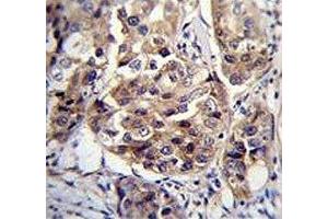 anti-hCG_1995004 (AA 116-144) antibody