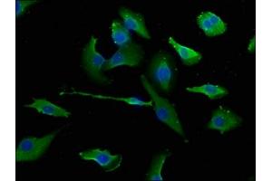 Immunofluorescence staining of U251 cells with ABIN7151510 at 1:133, counter-stained with DAPI. (ERC1 抗体  (AA 1-224))