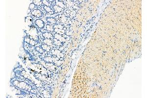 ABIN6262790 and ABIN6278915 at 1/100 staining Rat stomach tissue by IHC-P. (KRT9 抗体  (Internal Region))
