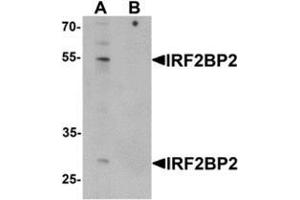 Western blot analysis of IRF2BP2 in HeLa cell lysate with IRF2BP2 Antibody  at 1 ug/mL in (A) the absence and (B) the presence of blocking peptide. (IRF2BP2 抗体  (C-Term))