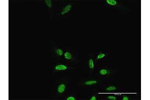 Immunofluorescence of purified MaxPab antibody to PRRX2 on HeLa cell. (PRRX2 抗体  (AA 1-253))