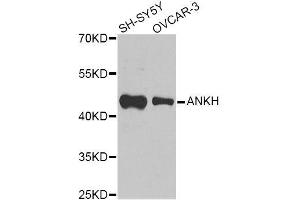 Western blot analysis of extracts of various cell lines, using ANKH Antibody (ABIN6003613) at 1/1000 dilution. (ANKH 抗体)
