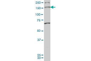 MYO3A monoclonal antibody (M01), clone 8D12 Western Blot analysis of MYO3A expression in Hela S3 NE . (MYO3A 抗体  (AA 1400-1490))
