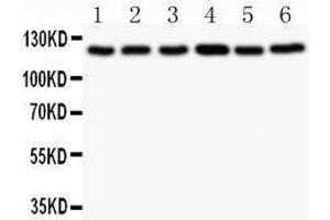 Observed bind size: 122KD (BUB1 抗体  (AA 731-1085))