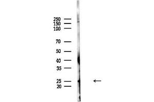 anti-Ribosomal Protein S5 (RPS5) (Internal Region) antibody