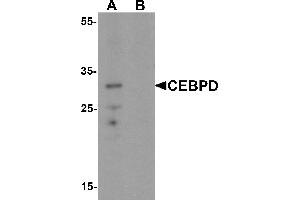 Western Blotting (WB) image for anti-CCAAT/enhancer Binding Protein (C/EBP), delta (CEBPD) (C-Term) antibody (ABIN1077390) (CEBPD 抗体  (C-Term))