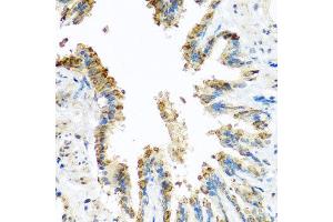 Immunohistochemistry of paraffin-embedded rat lung using BCKDK antibody at dilution of 1:100 (x40 lens).