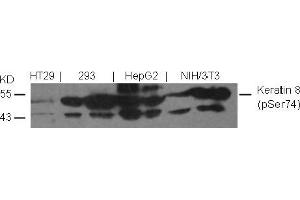 Image no. 2 for anti-Keratin 8 (KRT8) (pSer74) antibody (ABIN401538) (KRT8 抗体  (pSer74))