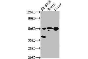Western Blot Positive WB detected in: SH-SY5Y whole cell lysate, Rat brain tissue, Rat liver tissue All lanes: SEPT11 antibody at 1:2000 Secondary Goat polyclonal to rabbit IgG at 1/50000 dilution Predicted band size: 50, 51 kDa Observed band size: 50 kDa (Septin 11 抗体  (AA 237-429))