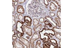 Immunohistochemical staining of human kidney with SLC35F4 polyclonal antibody  shows strong cytoplasmic positivity in cells in tubules at 1:200-1:500 dilution. (SLC35F4 抗体)